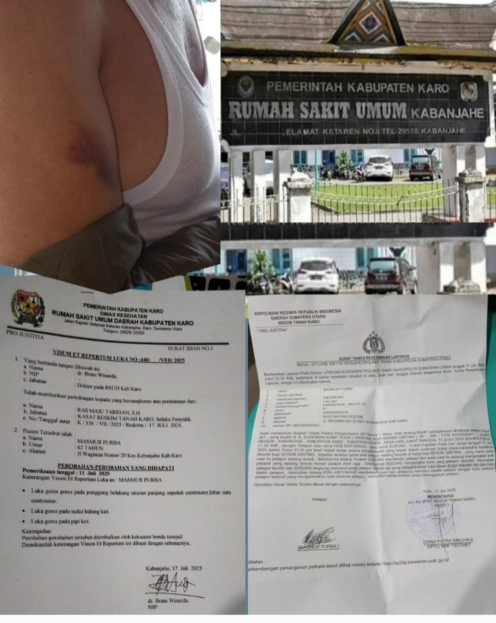 Oknum Dokter RSUD Kabanjahe dr. Bram Winarda Diduga Memanipulasi Hasi Visum Korban Pengeroyokan
