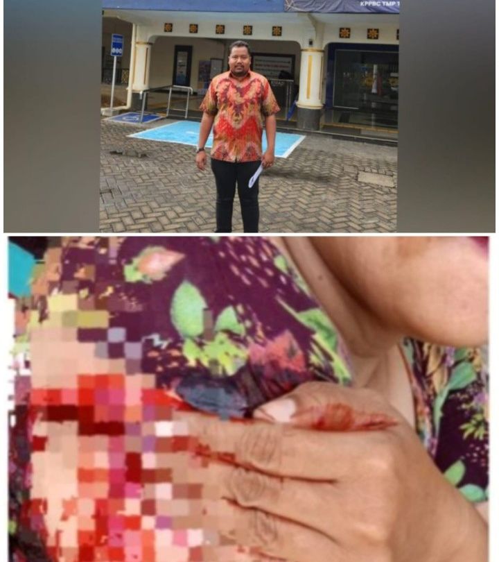 Begal Beraksi Brutal di Marelan Korban Dibacok, Praktisi Hukum Soroti Kinerja Aparat