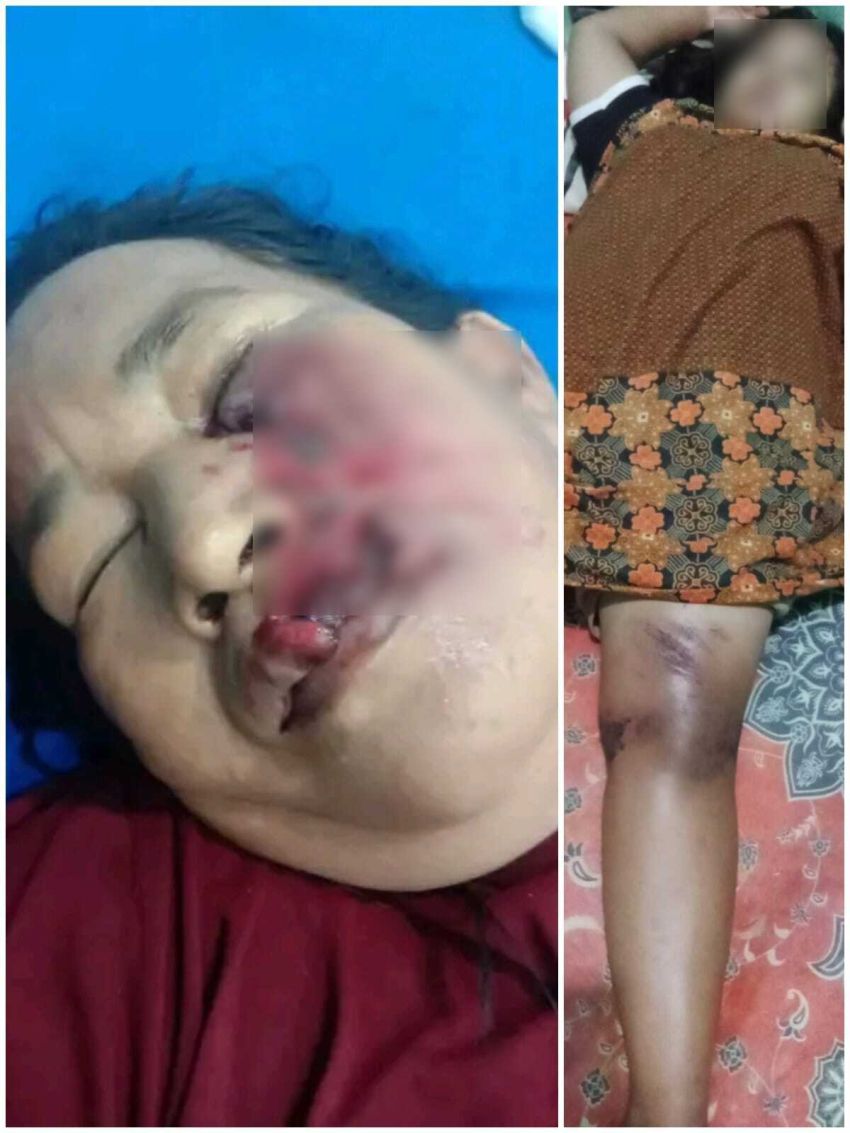 Awas Begal, Pedagang Pajak Pasar V Marelan Dibegal di Simpang Dobi