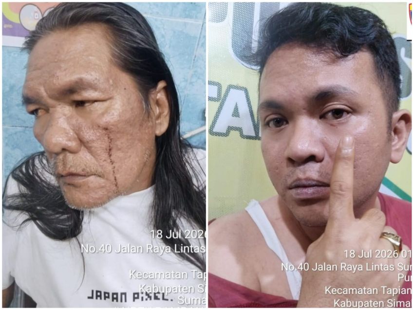 Warga Sinaksak Laporkan Oknum Diduga Panitera PN Pematangsiantar ke Polisi atas Dugaan Penganiayaan