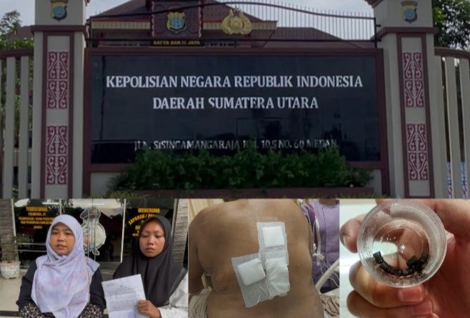 Diduga Diserang Usai Antar Doni Pacek ke Rumah Sakit, AS Nyaris Kehilangan Nyawa